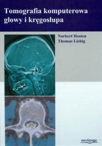 Tomografia komputerowa głowy i - okładka książki