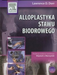 Alloplastyka stawu biodrowego (+ - okładka książki