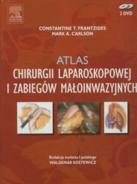 Atlas chirurgii laparoskopowej - okładka książki
