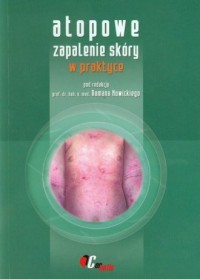 Atopowe zapalenie skóry w praktyce - okładka książki