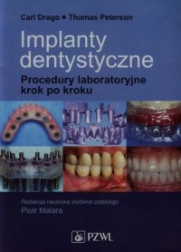 Implanty dentystyczne. Procedury - okładka książki