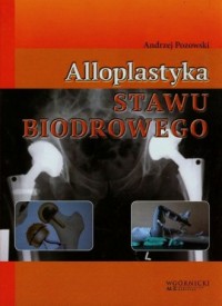 Alloplastyka stawu biodrowego - okładka książki