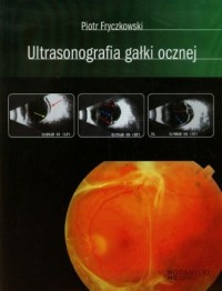 Ultrasonografia gałki ocznej - okładka książki