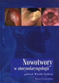 Nowotwory w otorynolaryngologii - okładka książki