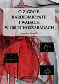 O zawale kardiomiopatii i wadach - okładka książki