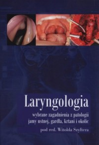 Laryngologia. Wybrane zagadnienia - okładka książki