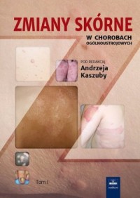 Zmiany skórne w chorobach ogólnoustrojowych. - okładka książki