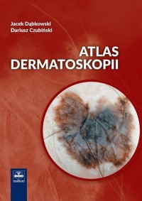 Atlas dermatoskopii - okładka książki