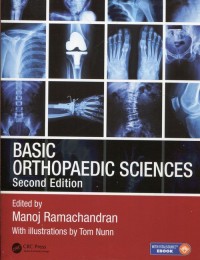 Basic Orthopaedic Sciences - okładka książki