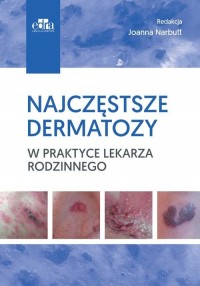 Najczęstsze dermatozy w praktyce - okładka książki