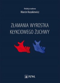 Złamania wyrostka kłykciowego żuchwy - okładka książki