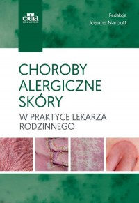 Choroby alergiczne skóry w praktyce - okładka książki