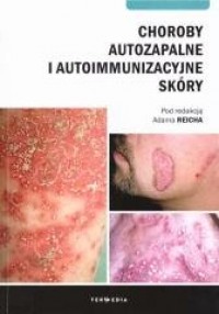 Choroby autozapalne i autoimmunizacyjne - okładka książki