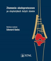 Złamania okołoprotezowe po aloplastykach - okładka książki