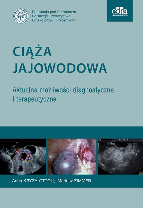Ciąża jajowodowa Aktualne możliwości - okładka książki