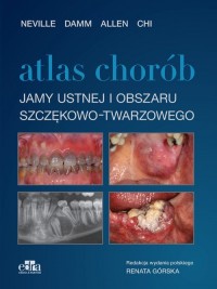 Atlas chorób jamy ustnej i obszaru - okładka książki