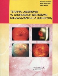 Terapia laserowa w chorobach siatkówki - okładka książki