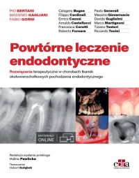 Powtórne leczenie endodontyczne - okładka książki