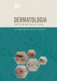 Dermatologia interwencyjna - okładka książki
