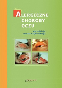 Alergiczne choroby oczu - okładka książki