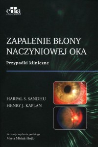 Zapalenie błony naczyniowej oka - okładka książki
