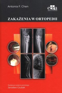 Zakażenia w ortopedii - okładka książki