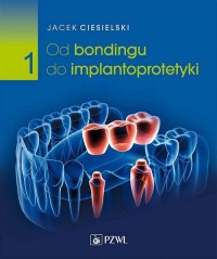 Od bondingu do implantoprotetyki - okładka książki