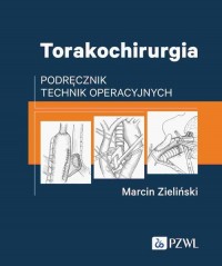 Torakochirurgia. Podręcznik technik - okładka książki