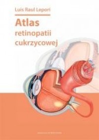 Atlas retinopatii cukrzycowej - okładka książki