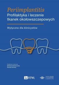 Periimplantitis. Profilaktyka i - okładka książki