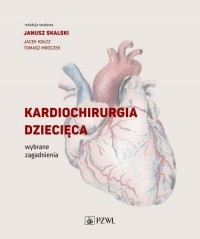 Kardiochirurgia dziecięca. Wybrane - okłakda ebooka