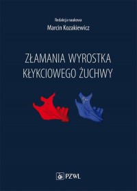 Złamania wyrostka kłykciowego żuchwy - okłakda ebooka