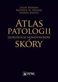 Atlas patologii złośliwych nowotworów - okłakda ebooka