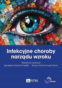 Infekcyjne choroby narządu wzroku - okłakda ebooka