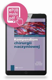 Kompendium chirurgii naczyniowej - okłakda ebooka