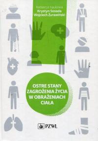 Ostre stany zagrożenia życia w - okłakda ebooka