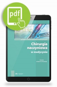 Chirurgia naczyniowa w medycynie - okłakda ebooka
