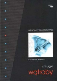 Chirurgia wątroby. Atlas techniki - okładka książki