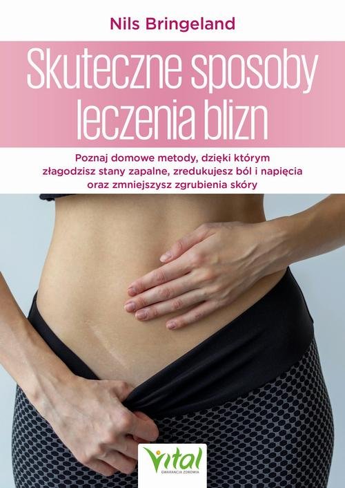 Skuteczne sposoby leczenia blizn - okłakda ebooka