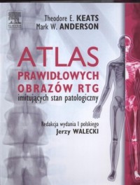 Atlas prawidłowych obrazów RTG - okładka książki